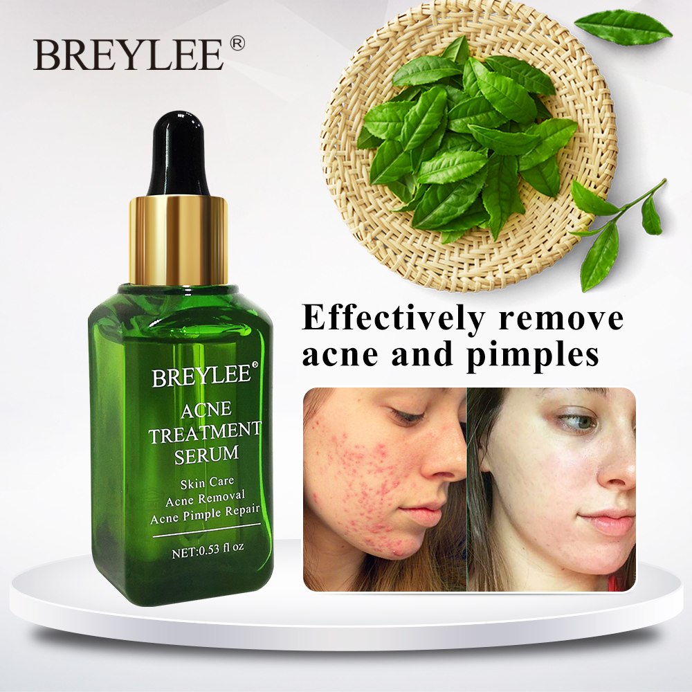 Clear Skin Pimple Solution