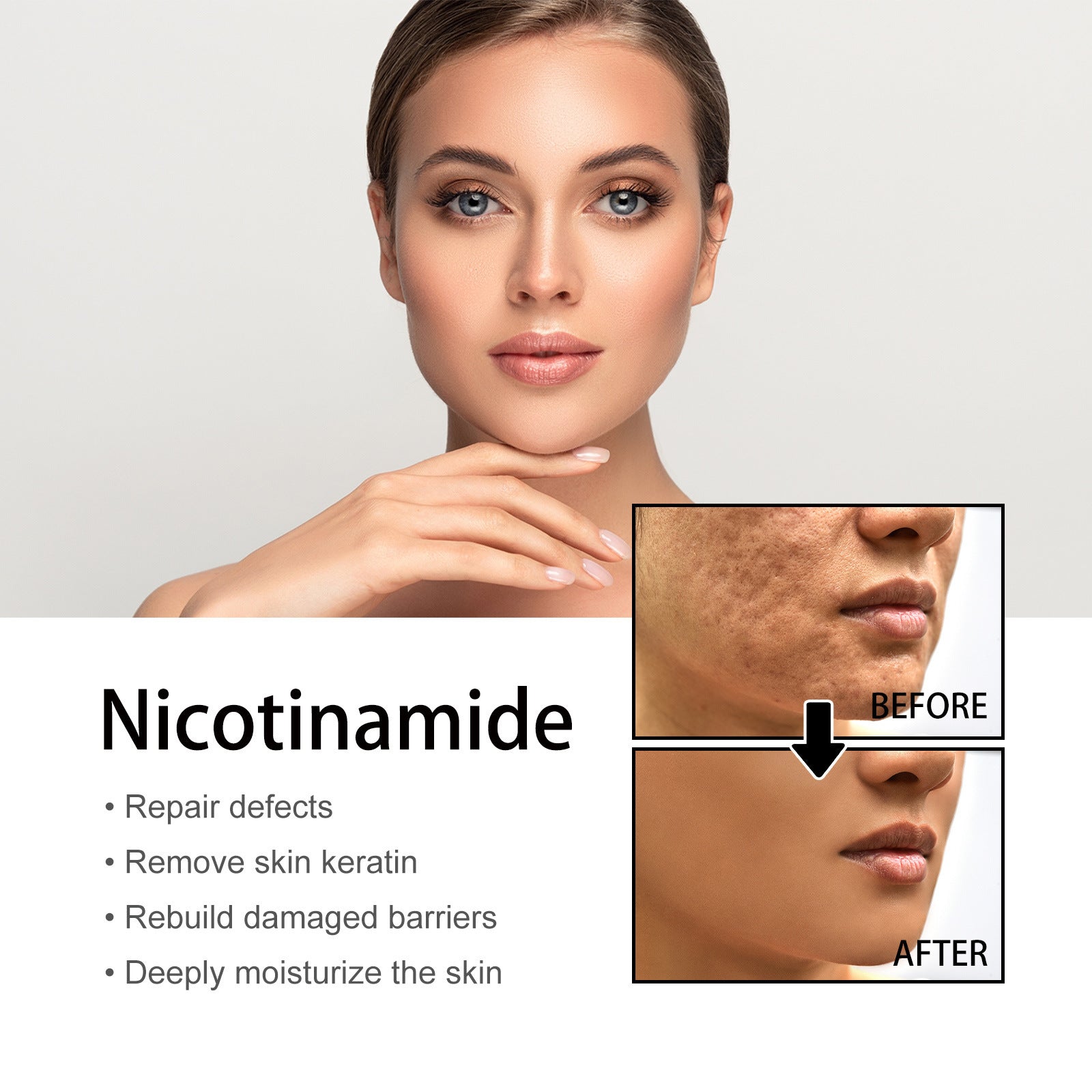 Niacinamide Facial Serum For Fading Acne Marks