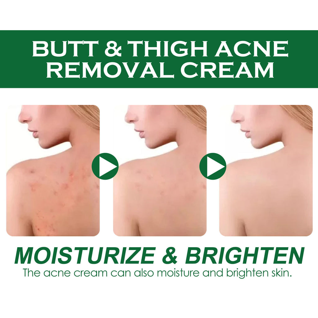 Clean And Repair Acne Smooth Skin Neck Cream
