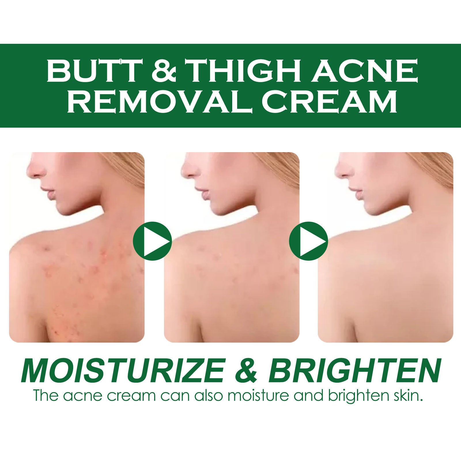 Clean And Repair Acne Smooth Skin Neck Cream